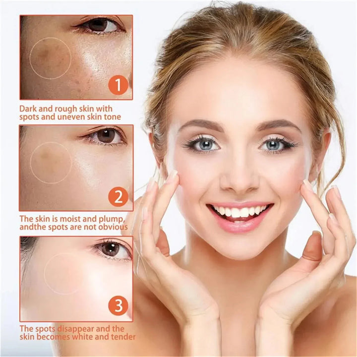 FACIAL CREAM FOR MELASMA