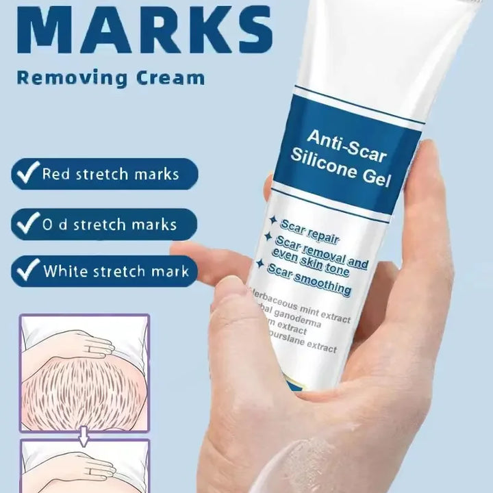 CREAM FOR STRETCH MARKS ON THE BELLY